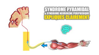 🔴 Syndrome pyramidal VS syndrome neurogène peripherique Expliqués Très Clairement par Dr Astuce [upl. by Irtimed]