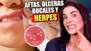 ¡COMPRIMIDO NATURAL y VITAMINAS contra el HERPES [upl. by Sancho301]