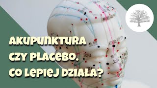 Czy akupunktura działa Badania naukowe [upl. by Tabbitha82]