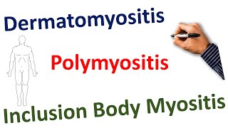 Dermatomyositis Polymyositis Inclusion Body Myositis STEP NCLEX COMLEX [upl. by Druce]