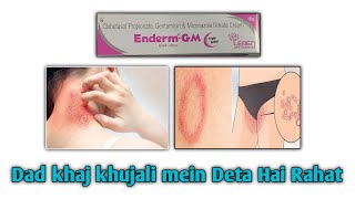 Enderm GM Cream Uses In Hindi  Side Effects  Benefits Full Review In Hindi [upl. by Arbba]