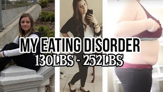 My Eating Disorder Story  Binge Eating [upl. by Alrzc]