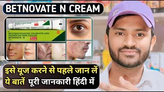 Betnovate n cream uses benefits and side effects full review in hindi [upl. by Ynnav906]