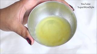 Get Rid of dandruff in 1 Day  Instant Dandruff Remedy at Home [upl. by Arleen]