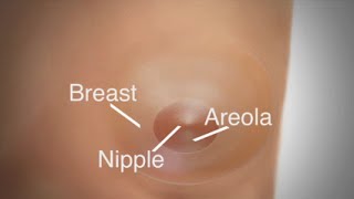 Mastectomy  Breast Reconstruction Overview [upl. by Airdnahs]