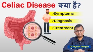 Celiac Disease क्या है जाने इस बिमारी के लक्षण  Diagnosis and Treatment  Foods to avoid in Celiac [upl. by Analihp]