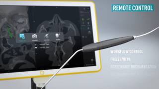 Kick® EM for ENT—Electromagnetic Navigation for Sinus Surgery [upl. by Urbano390]