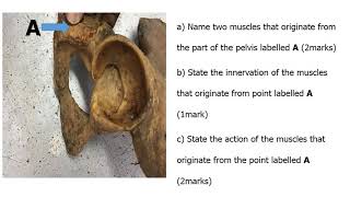 Posterior thigh and Popliteal Fossa Anatomy Anatomy revision with questions and answers [upl. by Netsrek]