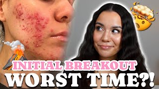 Facing The INITIAL BREAKOUT amp How to Navigate Through  Accutane EP3 [upl. by Nytsirt870]