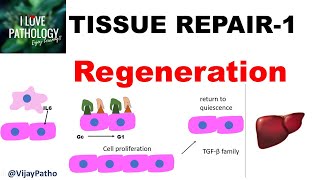 TISSUE REPAIR Part 1 Repair  Regeneration [upl. by Pansy]