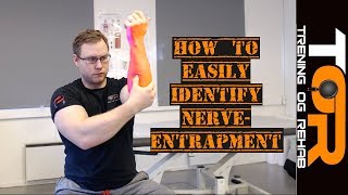 How to easily identify nerve entrapment syndromes [upl. by Zoe]