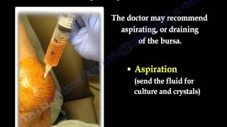 Elbow Bursitis Giant  Aspiration Spur  Everything You Need To Know  Dr Nabil Ebraheim [upl. by Nosde45]