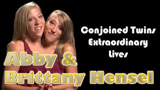 The Inspiring Journey of Conjoined Twins Abby and Brittany Hensel amp Embracing Lifes Challenges [upl. by Ellehcrad]