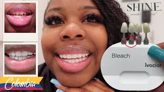 Colombia Solo Trip Getting Porcelain Veneers at Shine Smiles BL2 Shade VLOG [upl. by Nya]