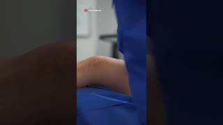 Watch our experts perform a minimally invasive varicose vein removal procedure varicoseveins 2024 [upl. by Tedder]