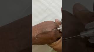 IV cannula insertiondocternursingmotivationviralvideoshortvideo [upl. by Torosian]