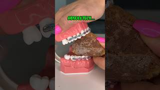 IS FREEZE DRIED CANDY SAFER FOR BRACES 🥶🍭👀 ORTHODONTIST REACTS JOLLY RANCHER NERDS FOOD ASMR [upl. by Neetsirhc]