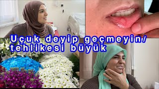 Ufak bir uçuk her şeyi iptal ettiameliyatlar ertelendi çok tehlikeli komaya gire bilirsin dedi Dr [upl. by Solange]