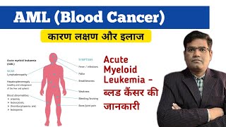 Acute Myeloid Leukemia AML Cause Symptoms Tests and Treatment Explained  Blood Cancer [upl. by Nnaeirb]