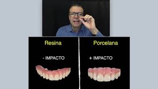 DENTADURA FIXA DE PORCELANA OU RESINA [upl. by Halimak]