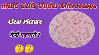 A clear Picture of nRBC  nRBC under microscope  RBC under microacope [upl. by Eniarrol]