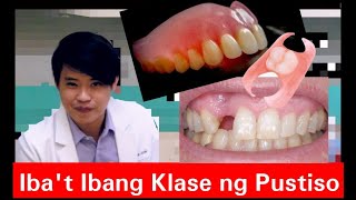 Ibat Ibang Klase ng PUSTISO Metal Flexible Stayplate Complete Denture 20 [upl. by Baldwin]