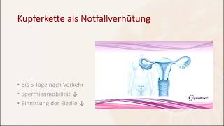 Kupferkette Gynefix hormonfreie Verhütung in Berlin  Frauenarztpraxis am Potsdamer Platz [upl. by Race]