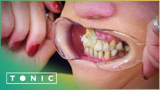 Woman Glues Her Teeth Back In Place To Avoid The Dentist  The Truth About Your Teeth  Tonic [upl. by Taylor]