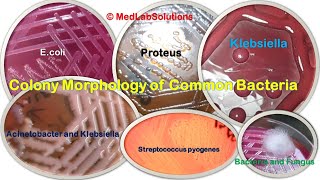 Various Common Bacteria Colony morphology E coli Klebsiella Staphylococcus Pseudomonas and More [upl. by Aridatha]