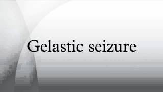 Gelastic seizure [upl. by Dett]