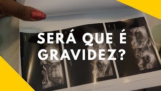 FIZ A ULTRA  GRAVIDA OU NÃO  DIARIO DE TENTANTE tentante [upl. by Eustache]