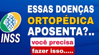 DOENÇAS ORTOPÉDICA APOSENTA POR INVALIDEZ [upl. by Ellenrad]