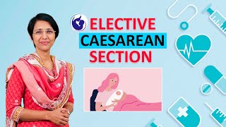 What is Elective C Section Cesarean section – Dr Rajeshwari Reddy Explains [upl. by Nelon]