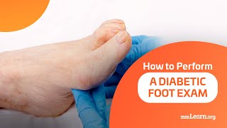 How to Perform A Diabetic Foot Exam [upl. by Webb738]