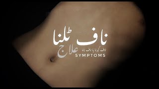 Navel Displacement  Causes  Symptoms amp Treatment  ناف کا ٹلنا یا ہٹنا کیا ہے [upl. by Hacceber148]