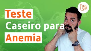 Rápido e Eficiente Teste Caseiro Para Anemia  Dr Rafael Freitas [upl. by Gusella]