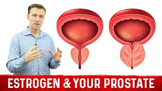 How To Fix Enlarged Prostate Explained By Dr Berg [upl. by Rellim]