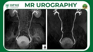 Magnetic Resonance Urography MRU MR Techniques amp Clinical Applications MIR Test amp Safety [upl. by Notnad360]