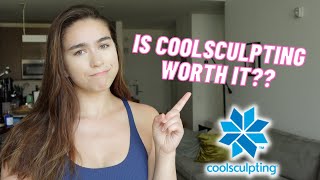 Was Coolsculpting worth it Before and after results [upl. by Oknuj]