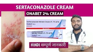 Sertaconazole cream in hindi  Onabet cream  Sertaconazole ointment [upl. by Irrem]