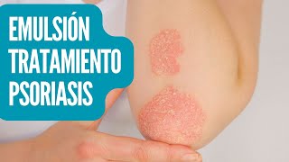 Cómo controlar la psoriasis triamcinolona urea salicílico [upl. by Inavoy627]