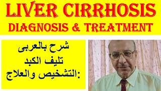 Liver cirrhosis  pathophysiology  diagnosis amp treatment شرح بالعربى تليف الكبد التشخيص والعلاج [upl. by Nowyt]