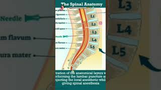 spinal anaesthesia process L3L4 opreat in delivery 🤰 [upl. by Aicatsal359]