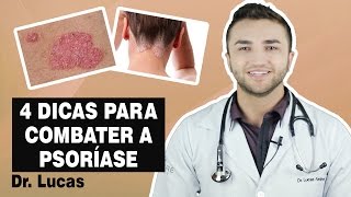 4 Dicas para COMBATER a Psoríase  Dr Lucas Fustinoni [upl. by Sielen]