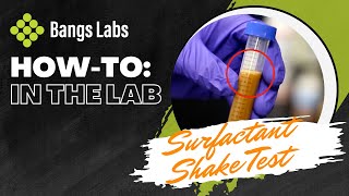 How To Surfactant Shake Test Demonstration [upl. by Lothaire]