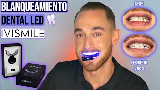 BLANQUEAMIENTO DENTAL CON LUZ LED [upl. by Brinna]