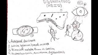 Hereditary Benign Intraepithelial Dyskeratosis [upl. by Inuat]