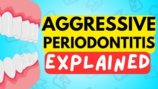 AGGRESSIVE PERIODONTITIS EXPLAINED IN 5 MINUTES  CAUSE DIAGNOSIS RISK FACTORS AND TREATMENT [upl. by Kyl175]