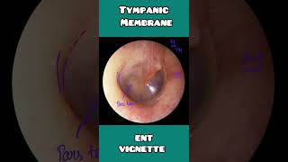 Tympanic membrane anatomy under 60 seconds  USMLE NCLEX  NEET PG [upl. by Kaile]