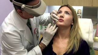 Juvederm Lip Filler  Total Dermatology [upl. by Rafferty]